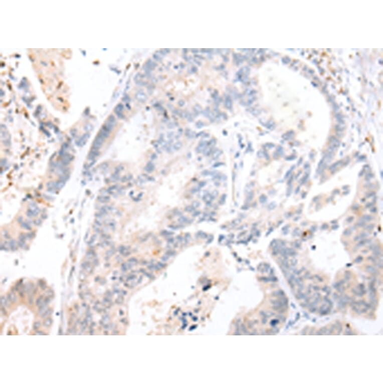 Immunohistochemistry - CALB2 Antibody from Signalway Antibody (43244) - Antibodies.com