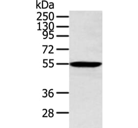 ALDH2 Antibody from Signalway Antibody (43248) - Antibodies.com