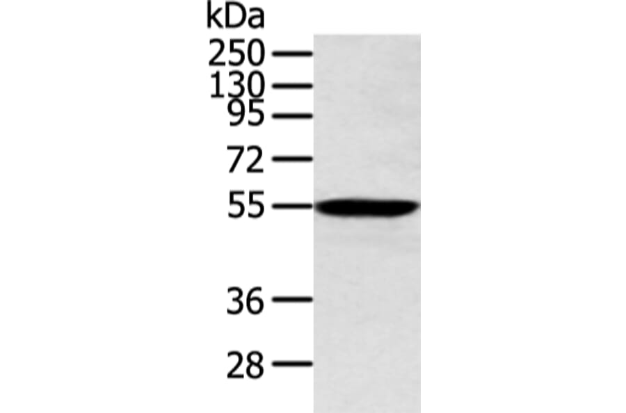 ALDH2 Antibody from Signalway Antibody (43248) - Antibodies.com