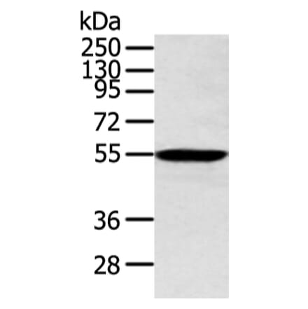 ALDH2 Antibody from Signalway Antibody (43248) - Antibodies.com