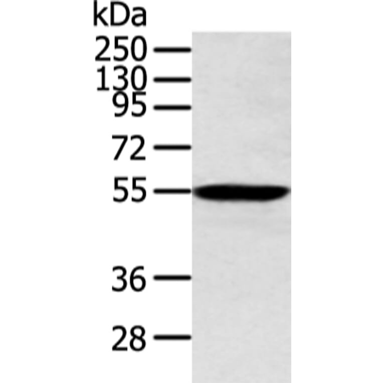 ALDH2 Antibody from Signalway Antibody (43248) - Antibodies.com