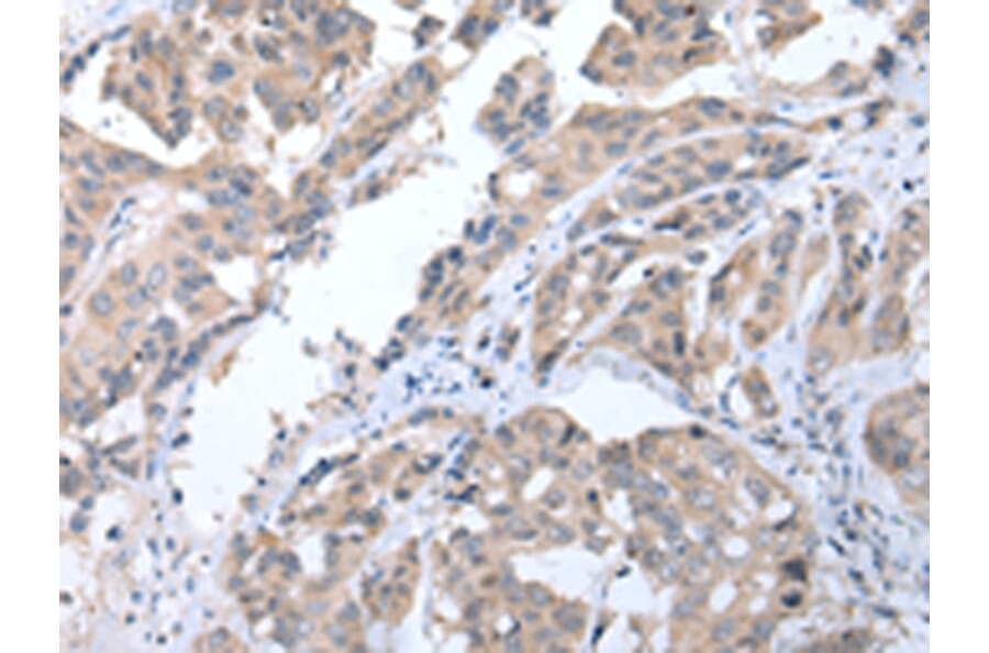 Immunohistochemistry - ALDH2 Antibody from Signalway Antibody (43248) - Antibodies.com