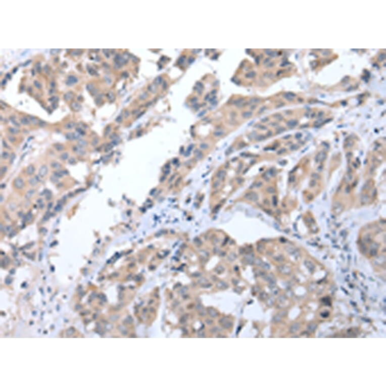 Immunohistochemistry - ALDH2 Antibody from Signalway Antibody (43248) - Antibodies.com
