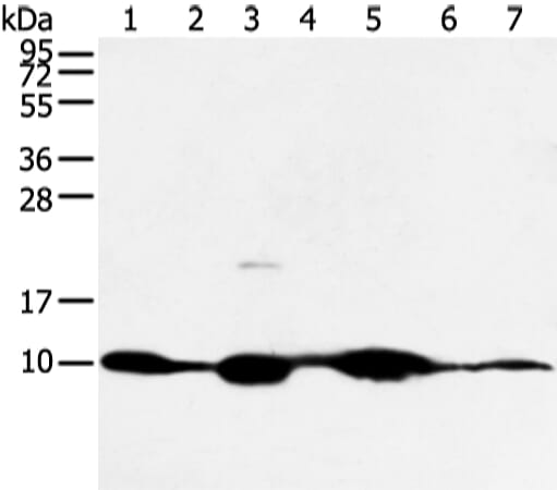 Gel: 12% SDS-PAGE Lysate: 40 &#956;g Lane 1-7: Mouse muscle and human fetal muscle tissue, mouse heart tissue and PC3 cell, mouse kidney and small intestines tissue, 231 cell Primary antibody: 1/300 dilution Secondary antibody: Goat anti rabbit IgG at 1/8000 dilution Exposure time: 5 minutes