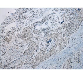 Immunohistochemistry - UBE2I Antibody from Signalway Antibody (43252) - Antibodies.com