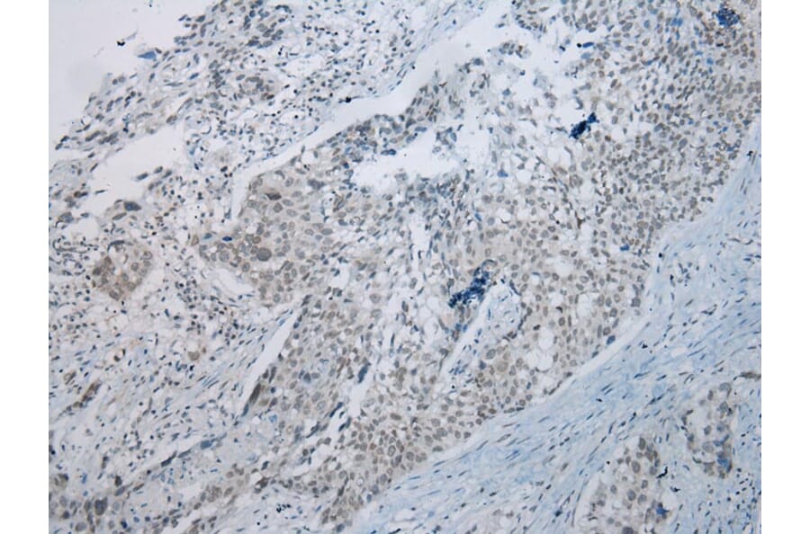 Immunohistochemistry - UBE2I Antibody from Signalway Antibody (43252) - Antibodies.com