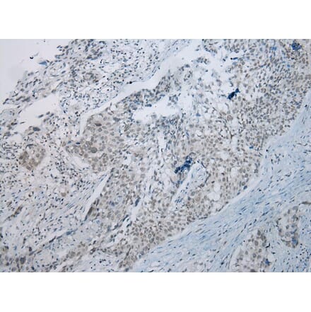 Immunohistochemistry - UBE2I Antibody from Signalway Antibody (43252) - Antibodies.com