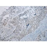 Immunohistochemistry - UBE2I Antibody from Signalway Antibody (43252) - Antibodies.com