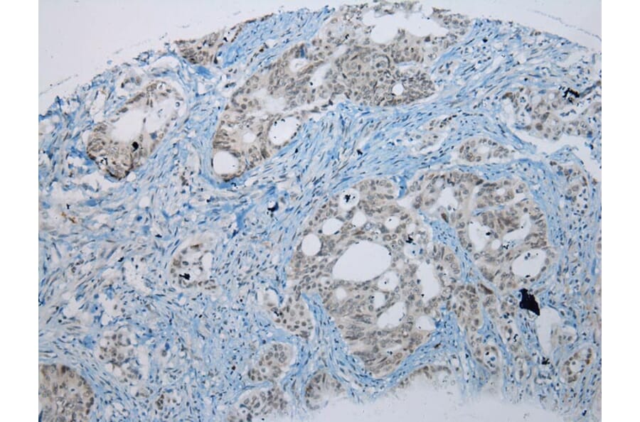 Immunohistochemistry - UBE2I Antibody from Signalway Antibody (43252) - Antibodies.com