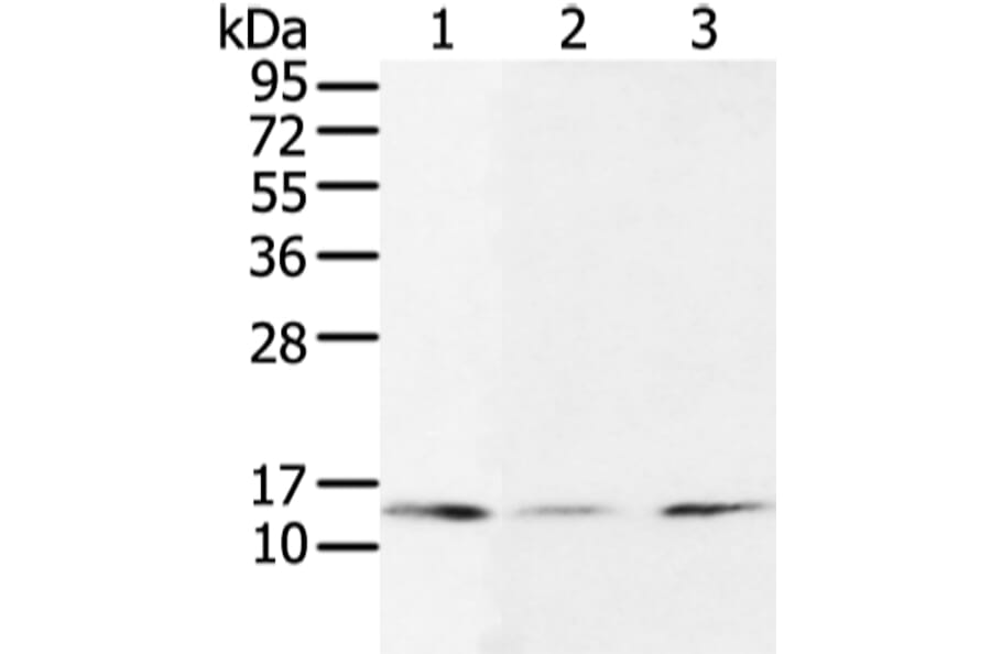UBE2I Antibody from Signalway Antibody (43252) - Antibodies.com