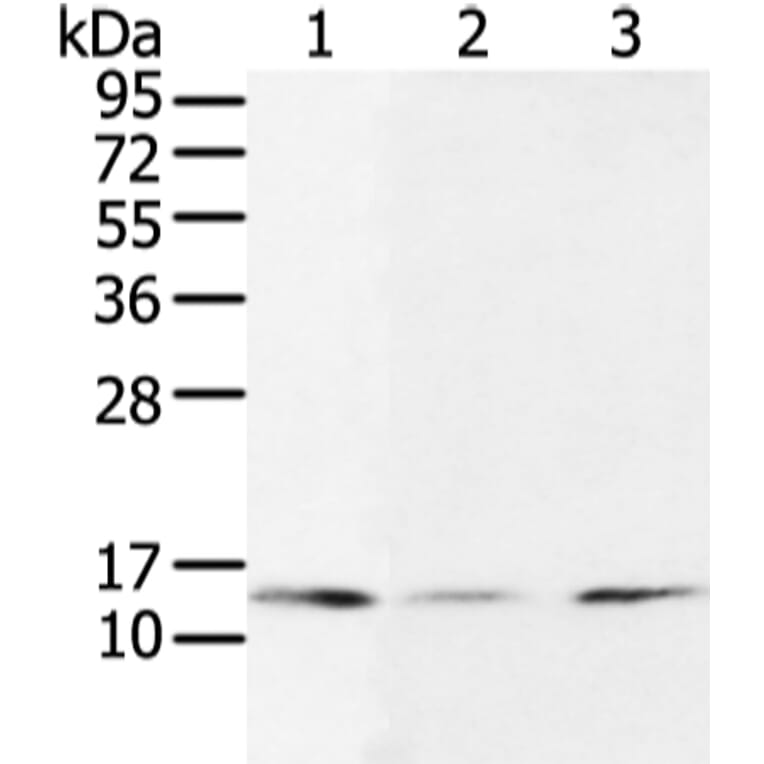 UBE2I Antibody from Signalway Antibody (43252) - Antibodies.com