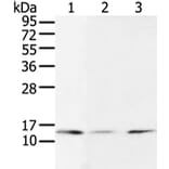 UBE2I Antibody from Signalway Antibody (43252) - Antibodies.com