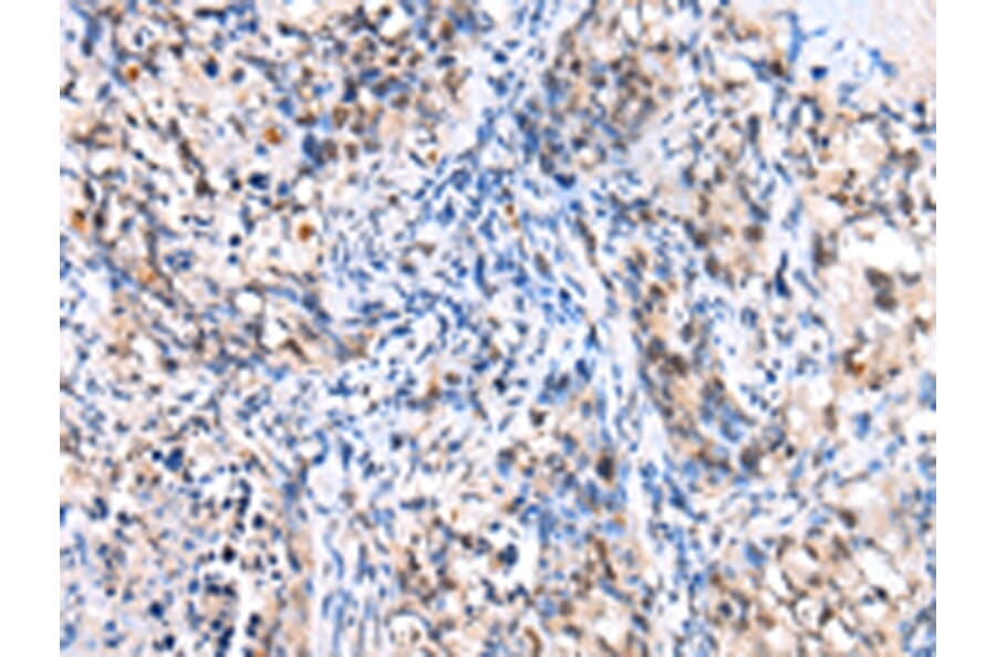 Immunohistochemistry - FOXP4 Antibody from Signalway Antibody (43272) - Antibodies.com