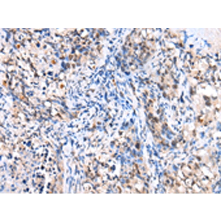 Immunohistochemistry - FOXP4 Antibody from Signalway Antibody (43272) - Antibodies.com