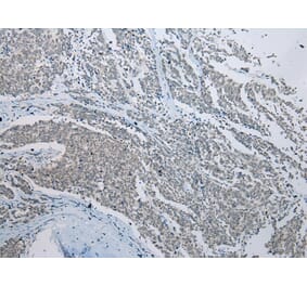 Immunohistochemistry - CCNG1 Antibody from Signalway Antibody (43289) - Antibodies.com
