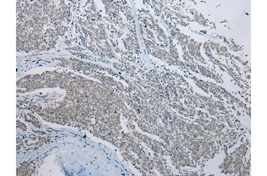 Immunohistochemistry - CCNG1 Antibody from Signalway Antibody (43289) - Antibodies.com