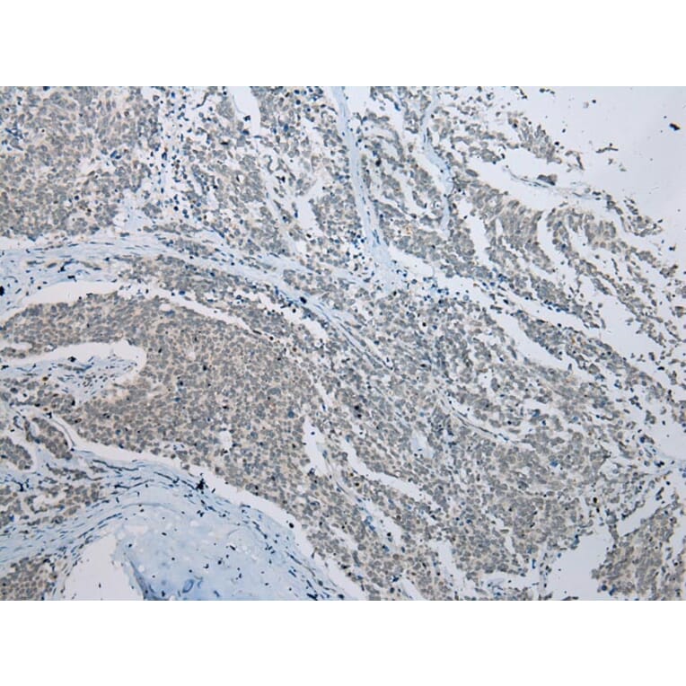 Immunohistochemistry - CCNG1 Antibody from Signalway Antibody (43289) - Antibodies.com