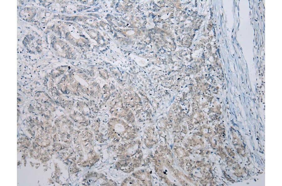Immunohistochemistry - CCNG1 Antibody from Signalway Antibody (43289) - Antibodies.com