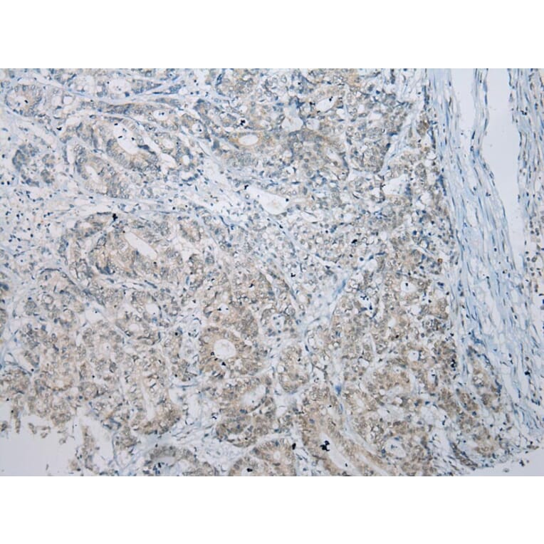 Immunohistochemistry - CCNG1 Antibody from Signalway Antibody (43289) - Antibodies.com