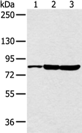 Gel: 6%SDS-PAGE Lysate: 40 &#956;g Lane 1-3: Jurkat£¬Hela and 293T cell Primary antibody: 1/250 dilution Secondary antibody: Goat anti rabbit IgG at 1/8000 dilution Exposure time: 10 seconds