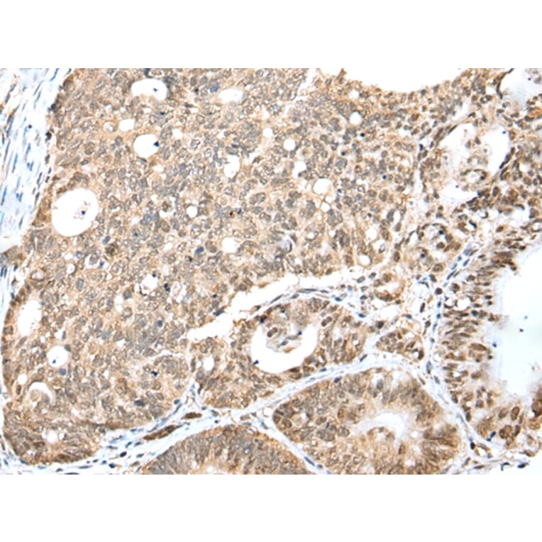 Immunohistochemistry - CCNT2 Antibody from Signalway Antibody (43292) - Antibodies.com