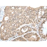 Immunohistochemistry - CCNT2 Antibody from Signalway Antibody (43292) - Antibodies.com