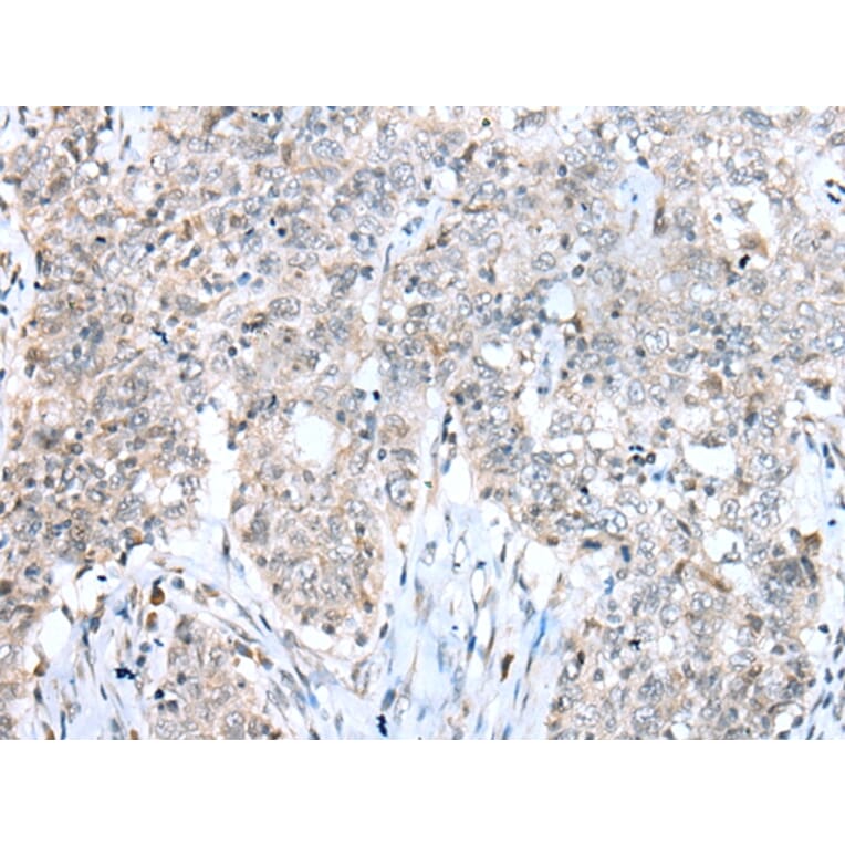 Immunohistochemistry - CCNT2 Antibody from Signalway Antibody (43292) - Antibodies.com