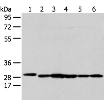 PRDX4 Antibody from Signalway Antibody (43303) - Antibodies.com