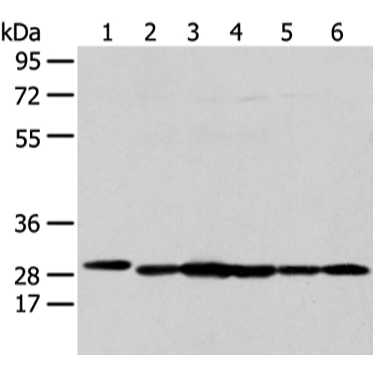 PRDX4 Antibody from Signalway Antibody (43303) - Antibodies.com