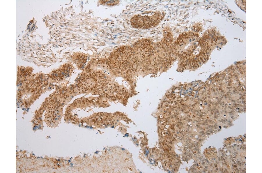 Immunohistochemistry - PPIL1 Antibody from Signalway Antibody (43322) - Antibodies.com