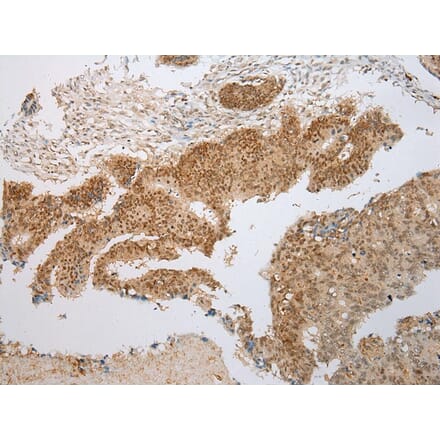 Immunohistochemistry - PPIL1 Antibody from Signalway Antibody (43322) - Antibodies.com