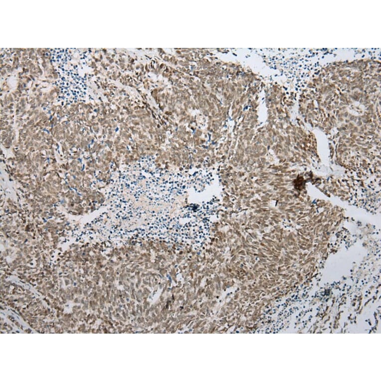 Immunohistochemistry - PPIL1 Antibody from Signalway Antibody (43322) - Antibodies.com