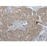 Immunohistochemistry - PPIL1 Antibody from Signalway Antibody (43322) - Antibodies.com