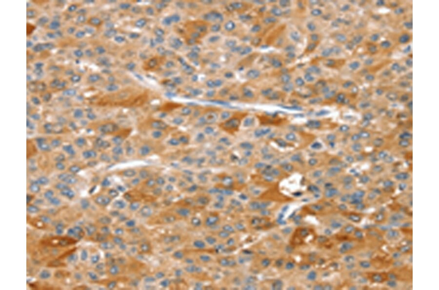 Immunohistochemistry - DSTYK Antibody from Signalway Antibody (43325) - Antibodies.com