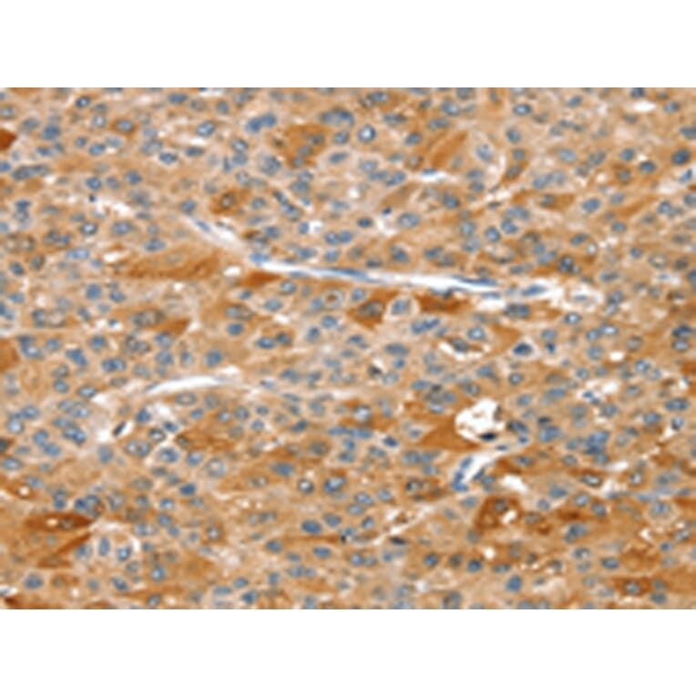 Immunohistochemistry - DSTYK Antibody from Signalway Antibody (43325) - Antibodies.com