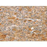 Immunohistochemistry - DSTYK Antibody from Signalway Antibody (43325) - Antibodies.com