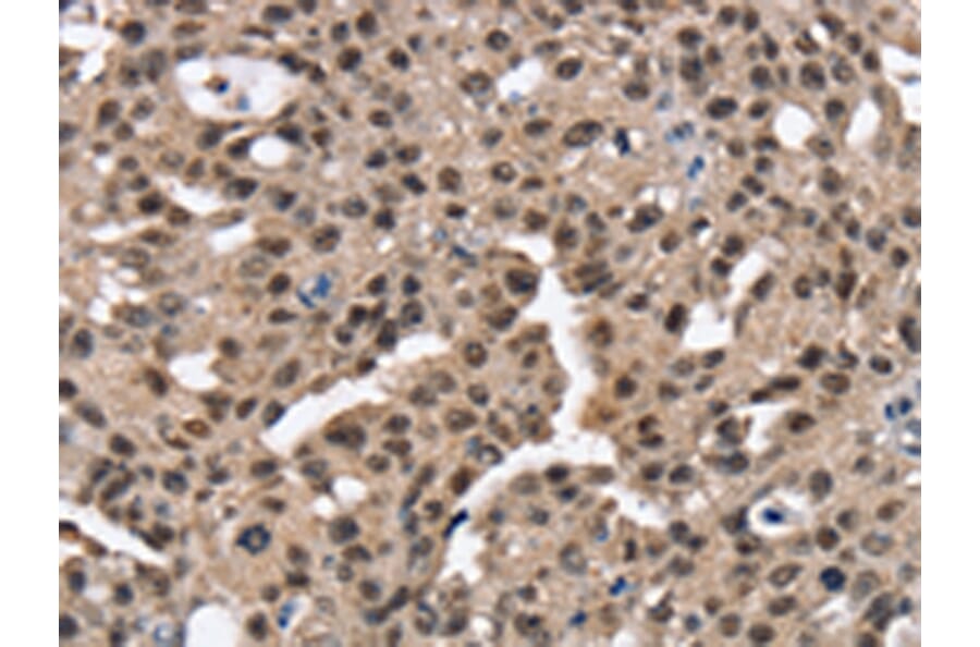 Immunohistochemistry - RNF40 Antibody from Signalway Antibody (43326) - Antibodies.com