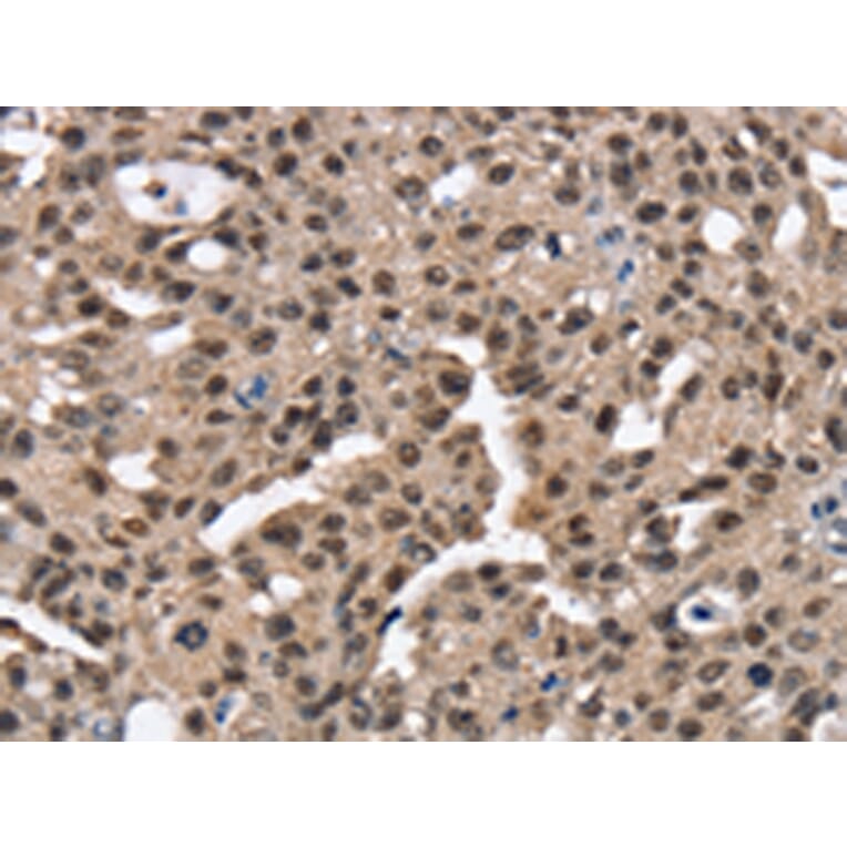 Immunohistochemistry - RNF40 Antibody from Signalway Antibody (43326) - Antibodies.com