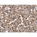 Immunohistochemistry - RNF40 Antibody from Signalway Antibody (43326) - Antibodies.com
