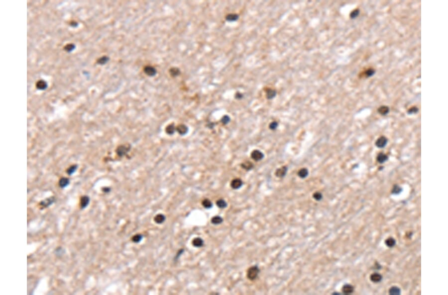 Immunohistochemistry - RNF40 Antibody from Signalway Antibody (43326) - Antibodies.com