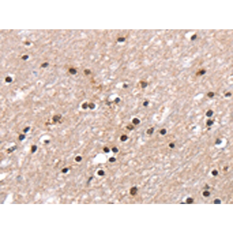 Immunohistochemistry - RNF40 Antibody from Signalway Antibody (43326) - Antibodies.com