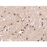 Immunohistochemistry - RNF40 Antibody from Signalway Antibody (43326) - Antibodies.com