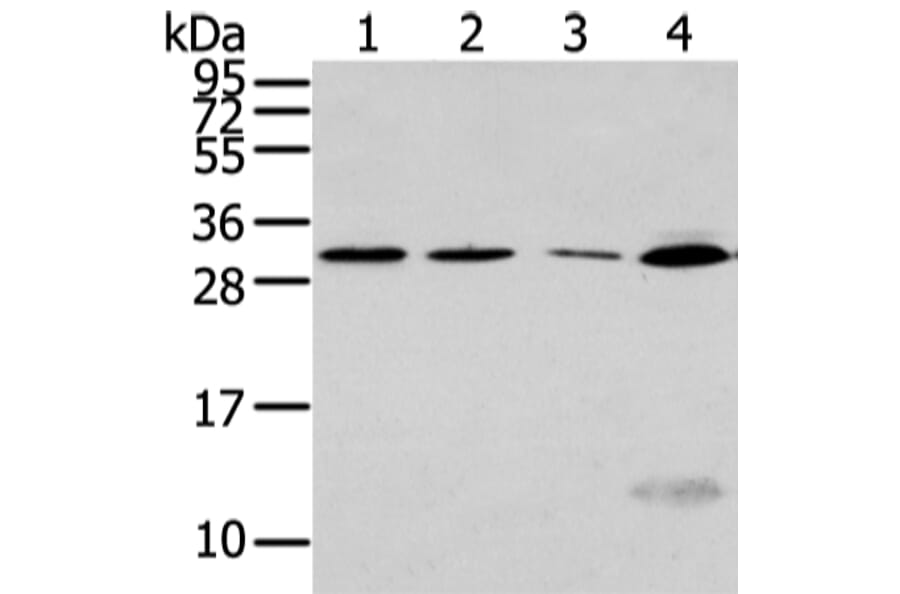 SIAH1 Antibody from Signalway Antibody (43329) - Antibodies.com