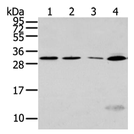 SIAH1 Antibody from Signalway Antibody (43329) - Antibodies.com