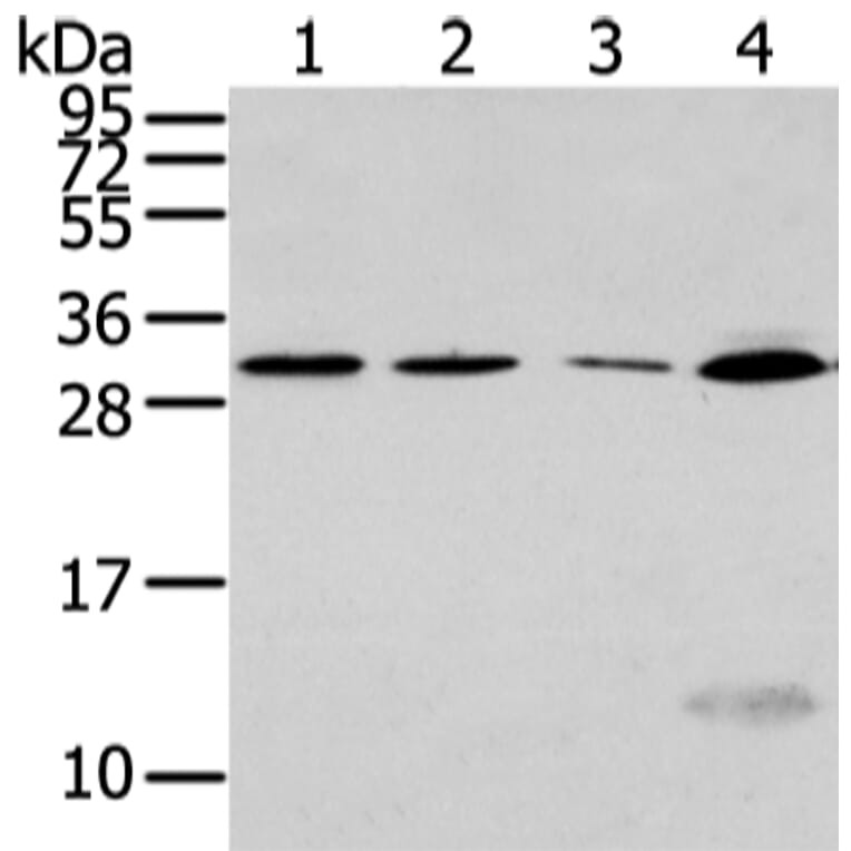 SIAH1 Antibody from Signalway Antibody (43329) - Antibodies.com