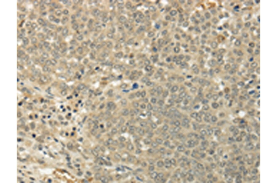 Immunohistochemistry - SIAH1 Antibody from Signalway Antibody (43329) - Antibodies.com
