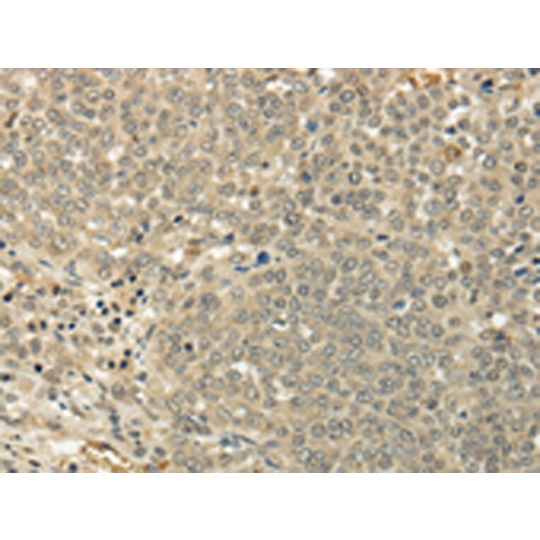 Immunohistochemistry - SIAH1 Antibody from Signalway Antibody (43329) - Antibodies.com