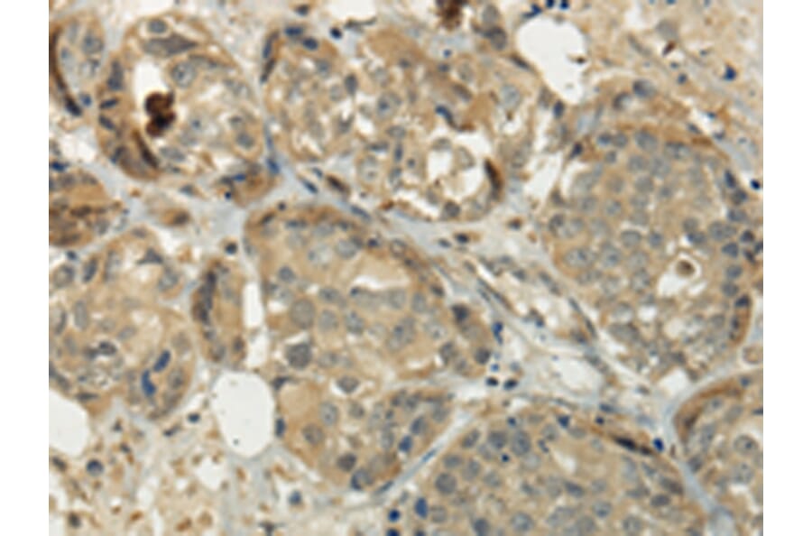 Immunohistochemistry - SIAH1 Antibody from Signalway Antibody (43329) - Antibodies.com