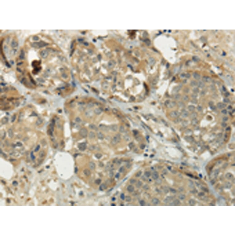Immunohistochemistry - SIAH1 Antibody from Signalway Antibody (43329) - Antibodies.com