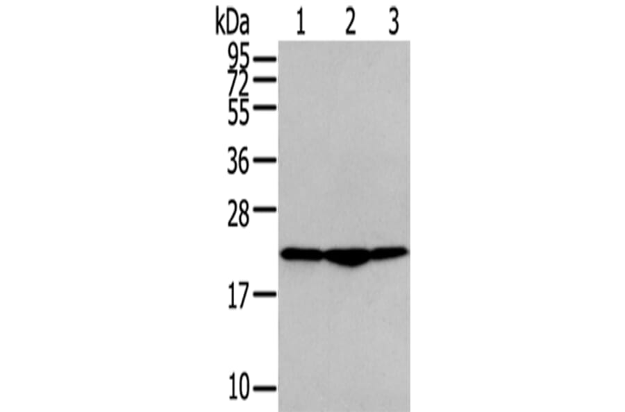 TMED2 Antibody from Signalway Antibody (43338) - Antibodies.com